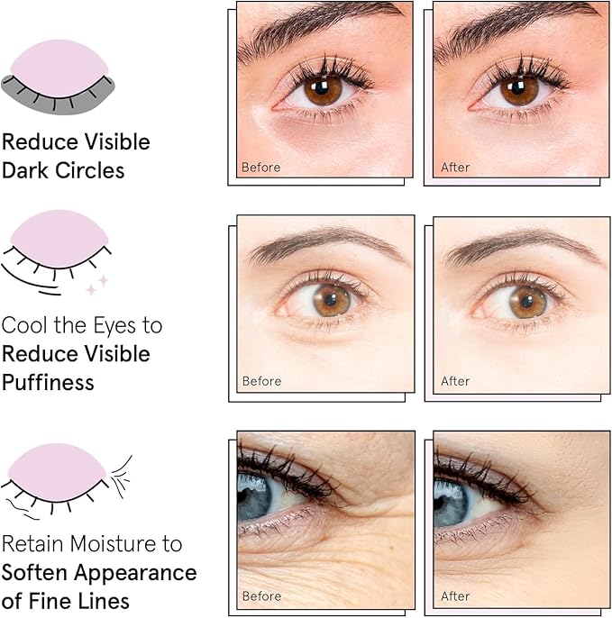 grace & stella Award Winning Under Eye Mask - Reduce Dark Circles, Puffy Eyes, Eye Bags, Wrinkles - Undereye Patches - Friendship Gifts for Women (Pink Eye Mask 48 Pairs + Hyaluronic Acid Serum 17ml)